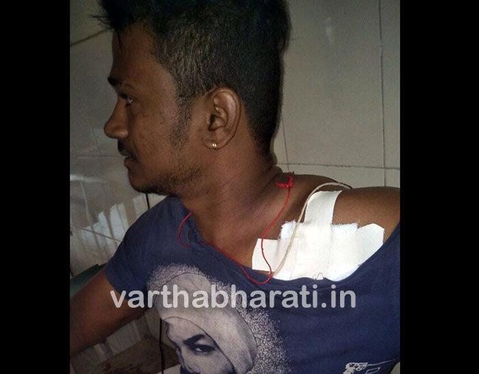 ಉಡುಪಿ ನಗರಸಭೆ ಸದಸ್ಯನಿಂದ ಯುವಕನಿಗೆ ಹಲ್ಲೆ : ದೂರು